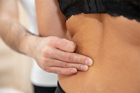 Bindegewebsmassage Medizinische Massage Therapie Zug