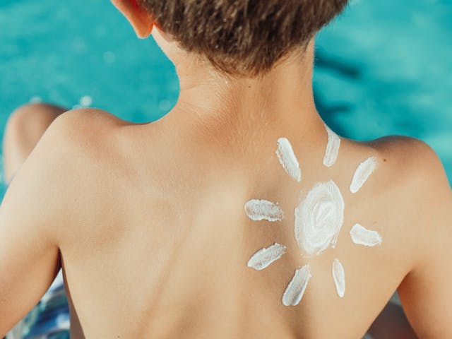 Sonnencreme schützt vor Hautkrebs - Junge mit einer Sonne aus Sonnencreme auf dem rechten Schulterblatt